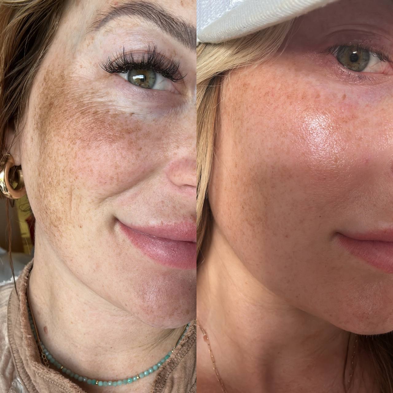 What Hooked Me on Plant Based Skincare