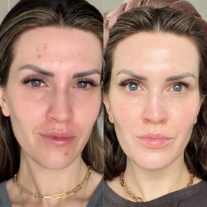 This Skincare Brand Gives You 12 Months to Love Their Products (Or Get a Refund)